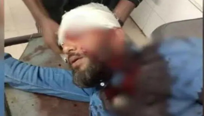 হাদির পর এনসিপি নেতা?!  খুলনায় প্রকাশ্যে এনসিপির নেতা মোতালেব শিকদারের মাথায় গুলি, অবস্থা আশঙ্কাজনক