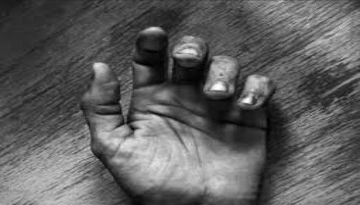 লক্ষ্মীপুরে বিএনপি নেতার বাড়িতে অগ্নিসংযোগ : প্রাণ গেল আরও একজনের