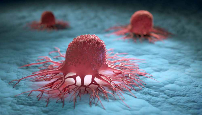 সময়মতো চিকিৎসায় অনেক ক্যানসারই নিরাময়যোগ্য: বিশেষজ্ঞদের জোর স্ক্রিনিং ও সচেতনতায়