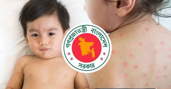 হামের উপসর্গে আরও ৪ শিশুর মৃত্যু, চলতি বছরে প্রাণহানি ৮৩৫