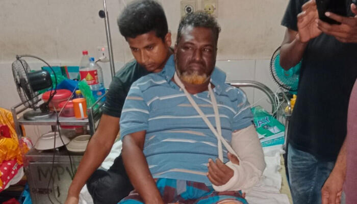 যশোরে চাঁদা না দেওয়ায় ইউপি চেয়ারম্যানকে পিটিয়ে হাত-পা ভাঙল সন্ত্রাসীরা