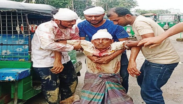 পটিয়ায় ভিটের বিরোধে সাবেক সেনা কর্মকর্তাসহ নারী-পুরুষ মিলিয়ে আহত ৬ জন