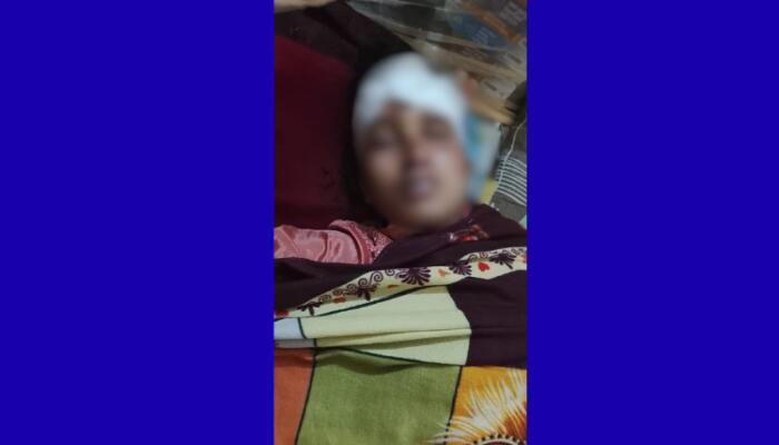 চট্টগ্রামে শপিং করতে গিয়ে ছিনতাইয়ের কবলে মাদারাসা শিক্ষার্থী